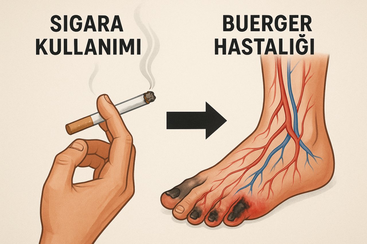 Buerger Hastalığı Nedir?