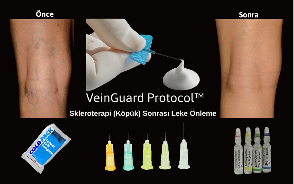 Skleroterapi Sonrası Leke Önleme