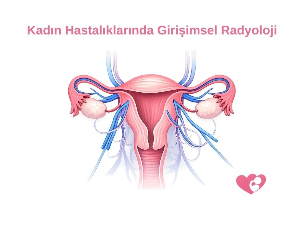 Kadın Hastalıklarında Girişimsel Radyoloji