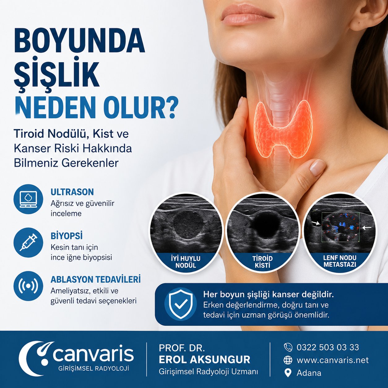 Boyunda Şişlik, Tiroid Nodülü, Kist ve Tiroid Kanseri