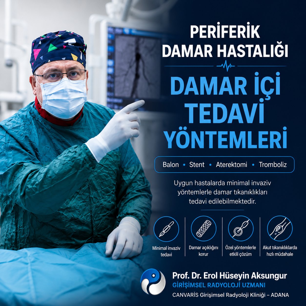 Periferik Damar Hastalığı Tedavisi: Balon, Stent, Aterektomi ve Tromboliz