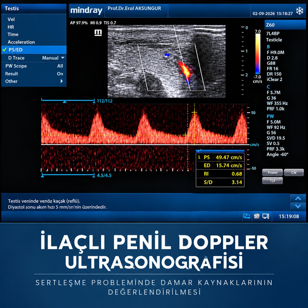 İlaçlı Penil Doppler Ultrasonografisi Adana